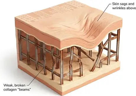 Collagen structure deep in the dermis