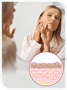 How much collagen you have left to work with