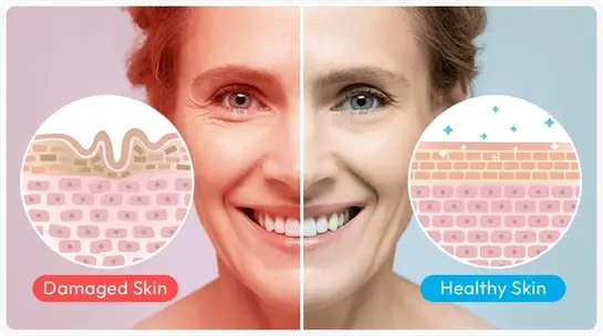 What is happening inside the skin, not on it